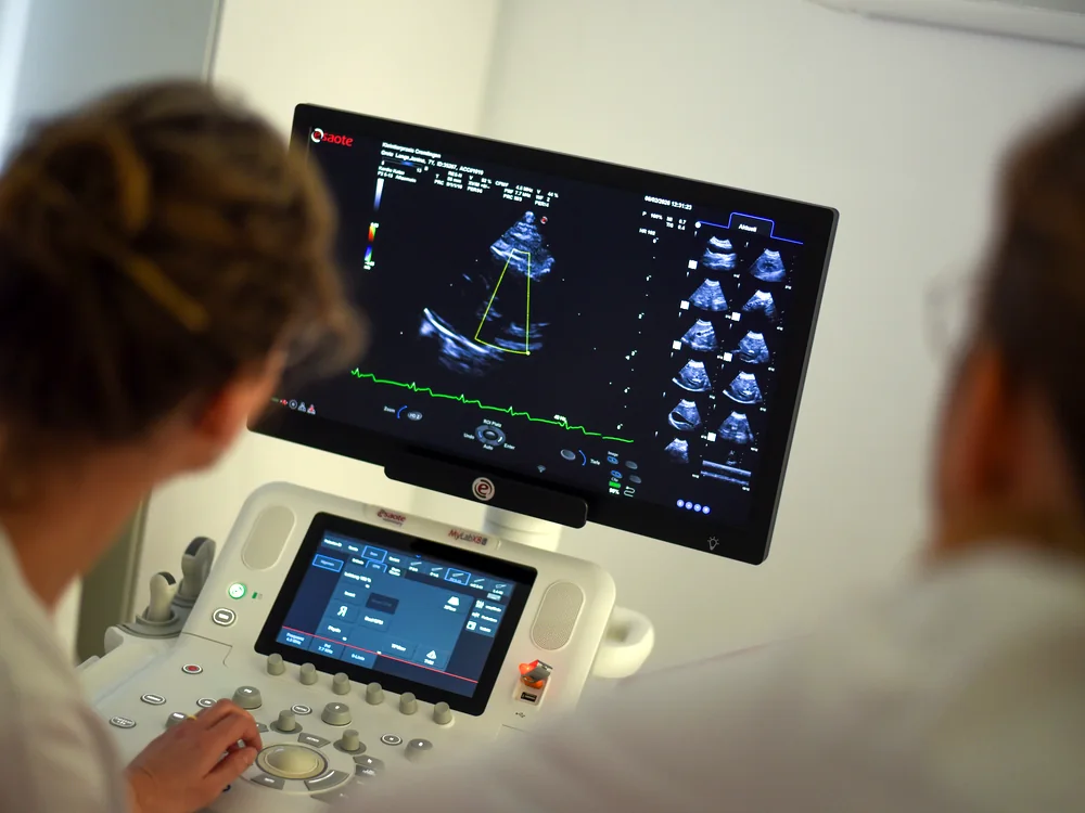 Echocardiography: cardiac ultrasound on the diagnostic system at Kleintierpraxis Cremlingen.