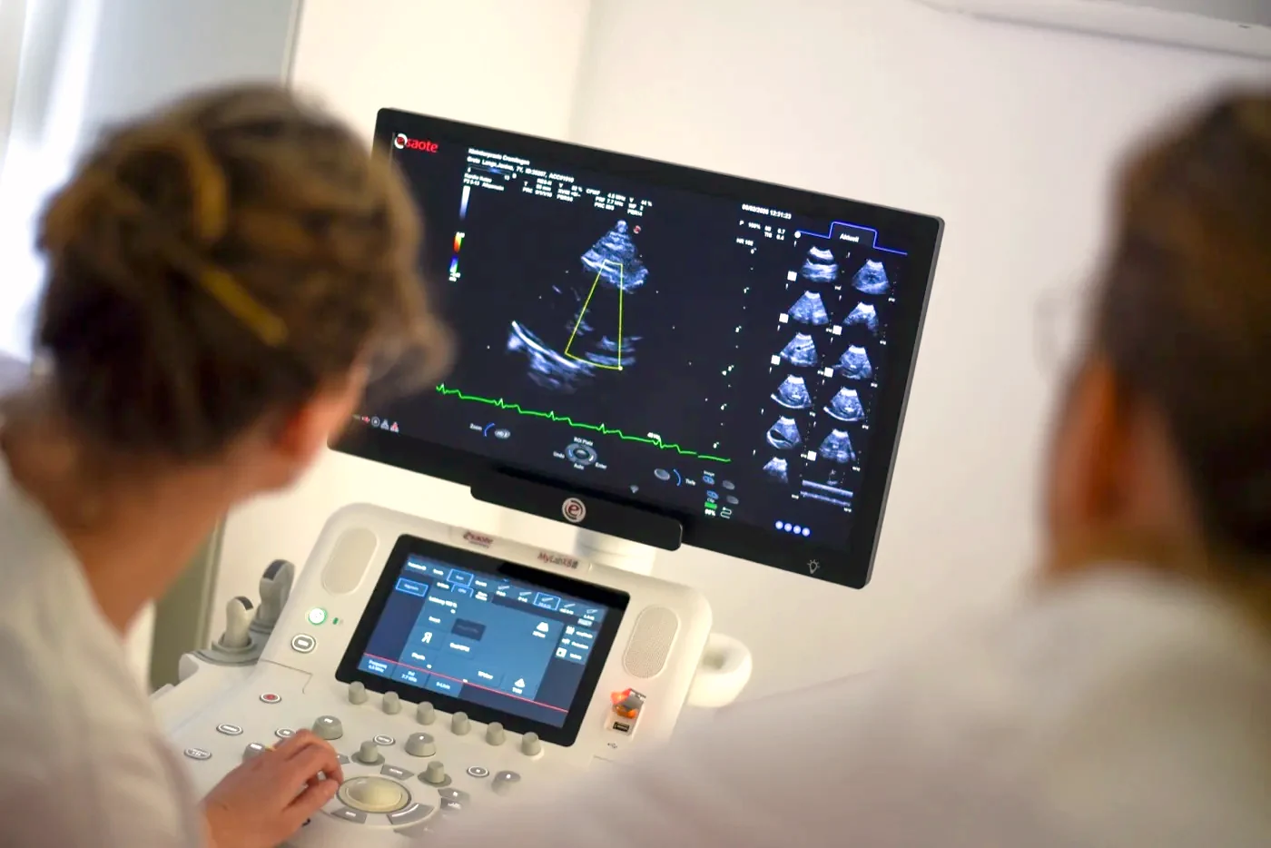 Reviewing a cardiac ultrasound on the diagnostic monitor.